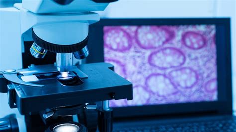 Roche Ibex And Amazon Partner For AI Enabled Digital Pathology