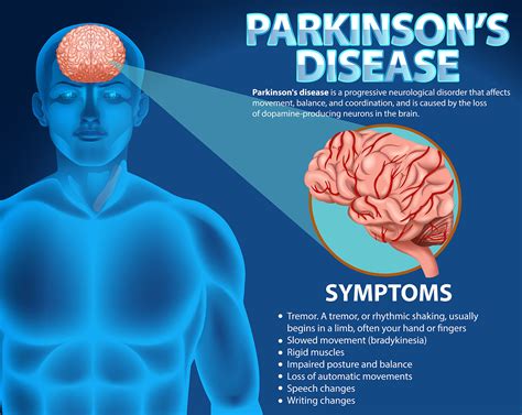 Parkinson S Disease Symptoms Causes Treatments Specialists