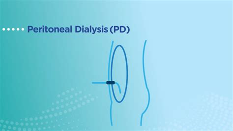 Benefits of peritoneal dialysis | Baxter Empowers