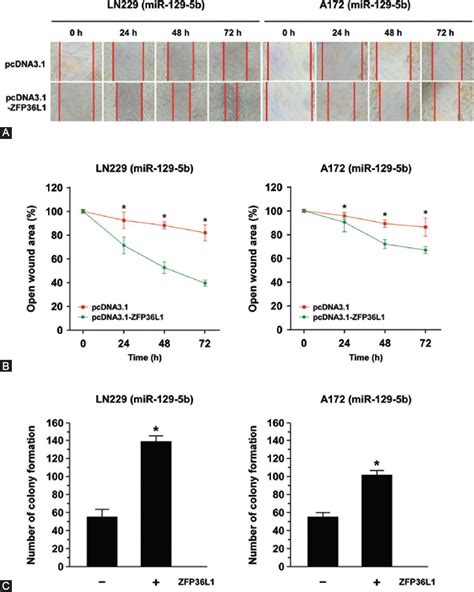 Overexpression Of Microrna 129 5p In Glioblastoma Inhibits Cell