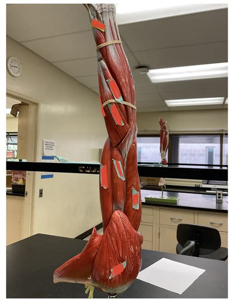 Muscles Of Arms Pt 1 Diagram Quizlet