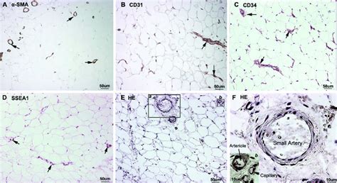 Immunohistochemical Localization Of Vascular And Stem Cell Markers In