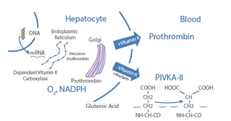 PIVKA II A Biomarker Of Liver Cells For The Management Of