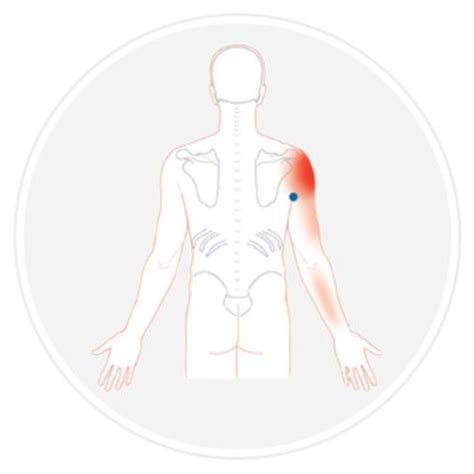 Trigger Point Therapy Treating Teres Major Trigger Point Therapy