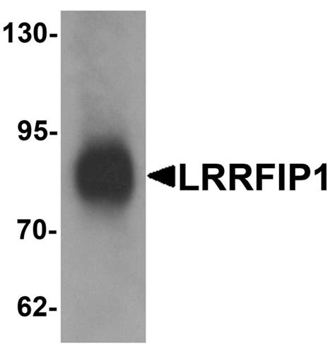 IHC Plus TRIP LRRFIP1 Polyclonal Antibody Rabbit Anti Human LSBio