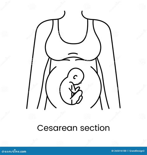 Caesarean Section Views Icon Line In Vector Illustration Of A Pregnant