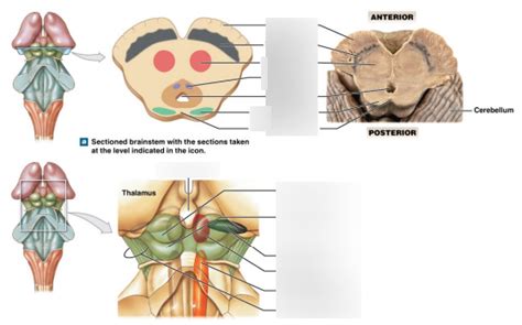 Mesencephalon Diagram | Quizlet