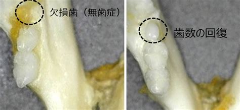 W Japonii Rozpoczynaj Si Badania Kliniczne Leku Wspomagaj Cego Wzrost