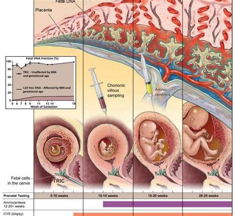 Study Reveals Non Invasive Prenatal Genetic Test Is Accurate Five Weeks