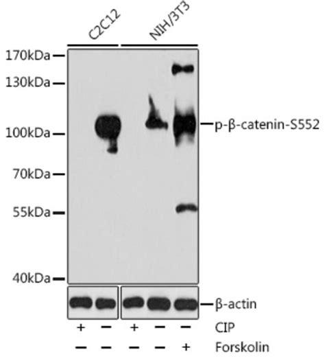 Anti Phospho Beta Catenin S552 Antibody Produced In Rabbit