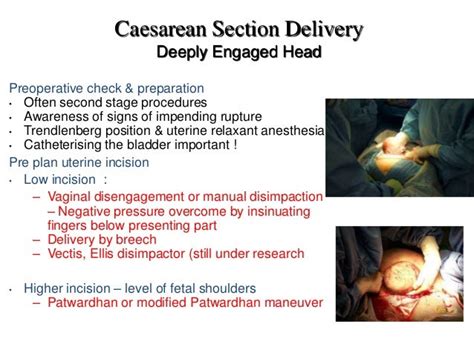 Difficult C Section