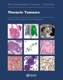 IARC Publications Website Thoracic Tumours