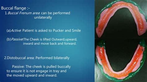 Border Moulding In Complete Denture Prosthesis