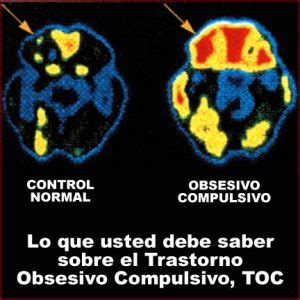 TOC Salud Mental Merida