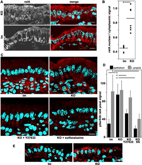 Activation of NF κB in of Prkci flox flox Vil CRE KO villus