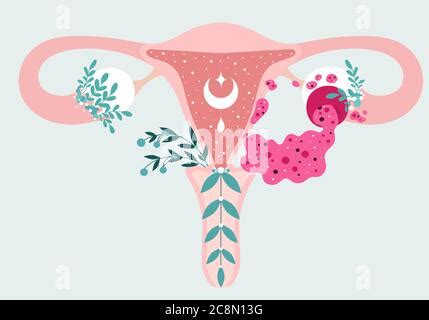 Ovarian Cyst Diagram Female Reproductive System Uterus Labeled In