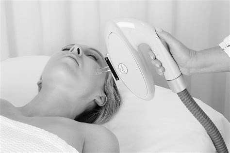ipl laser facial attraction