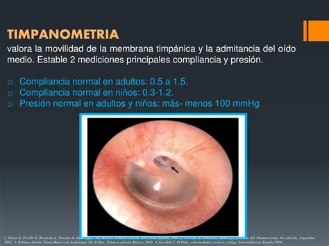 Ppt Acumetria Audiometria Logoaudiometria Impedanciometria Powerpoint Presentation Id1014758