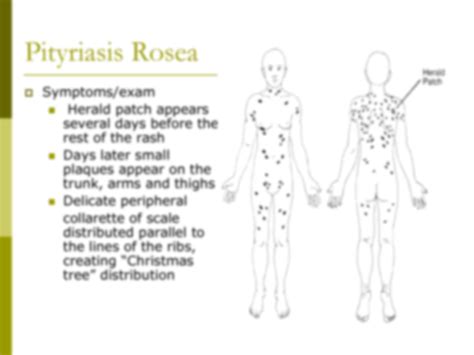 Solution Dermatology Pityriasis Rosea Studypool