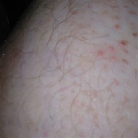 BBC Fucks My Huge Chub Ass Free Gay Chub Porn 79 XHamster XHamster