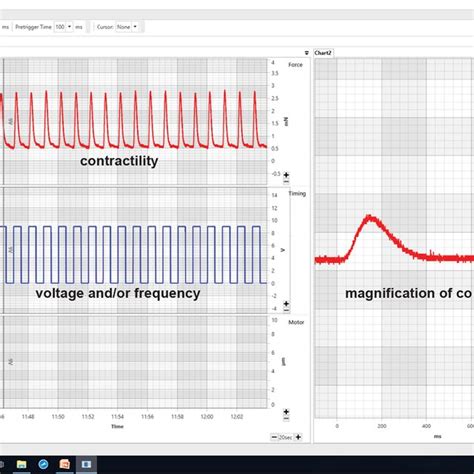 Interface Of Myodat Recording Software On Computer Screen The Red