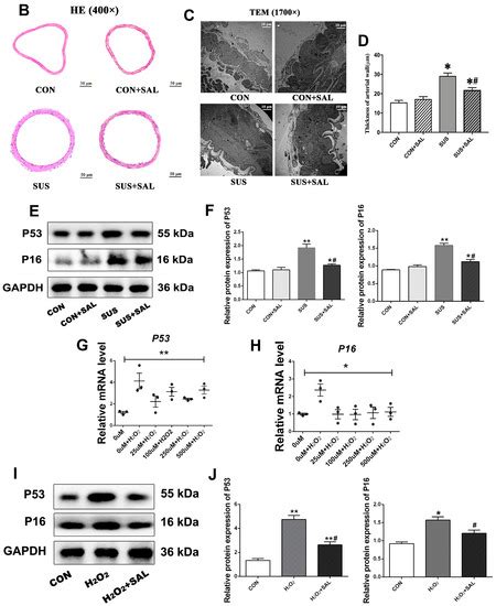 IJMS Free Full Text Discovery Of Salidroside As A Novel Non Coding