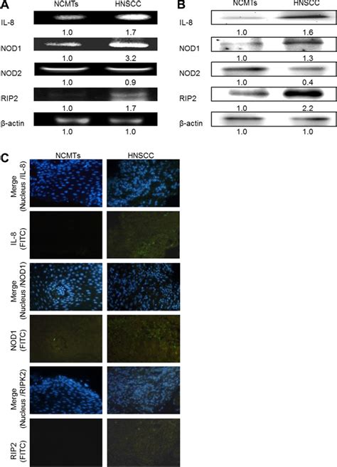 PDF IL 8 Promotes HNSCC Progression On CXCR1 2 Meidated NOD1 RIP2