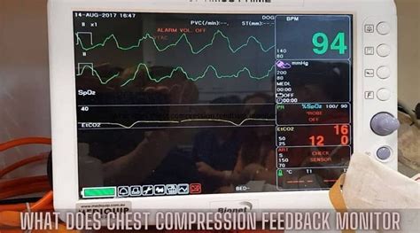 What Does a Chest Compression Feedback Device Monitor?