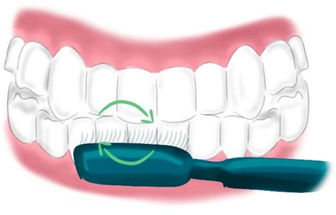 Tecnicas De Cepillado Dental