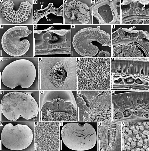 Scanning Electron Microscopy Of Seed Coat Or Pericarp In Control And