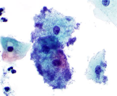 Cytopathology Abstract Artwork Science Nerd Abstract