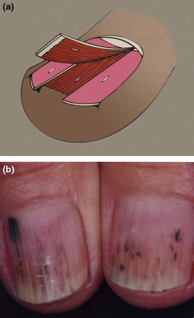 Nail Biology And Nail Science De Berker 2007 International