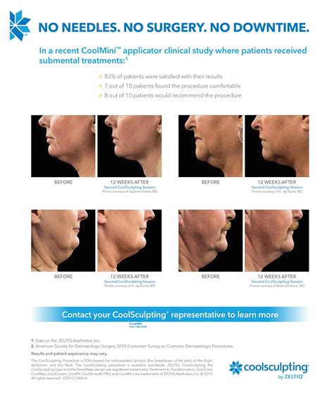 diy coolsculpting double chin - Sharyn Abreu