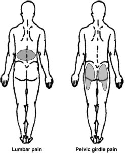 pelvic girdle pain | Physiotherapy Victoria BC