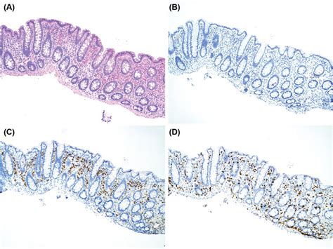 Characterization Of Colonic Biopsies By Histology And Download Scientific Diagram