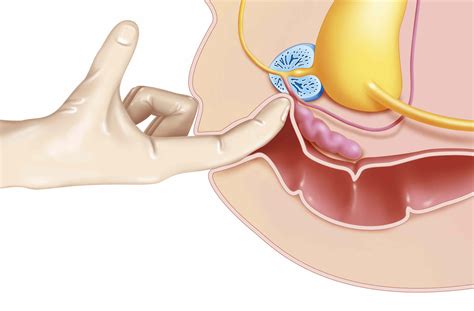 How To Stimulate The Prostate Telegraph