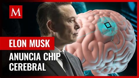 Chips Cerebrales De Neuralink La Puerta Hacia La Integraci N Mente