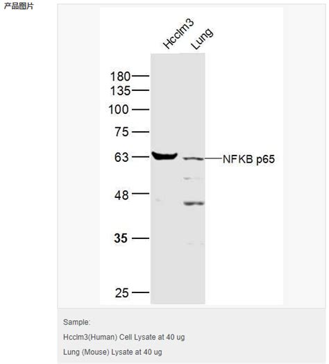 细胞核因子nfkbp65抗体 北京拜尔迪生物技术有限公司