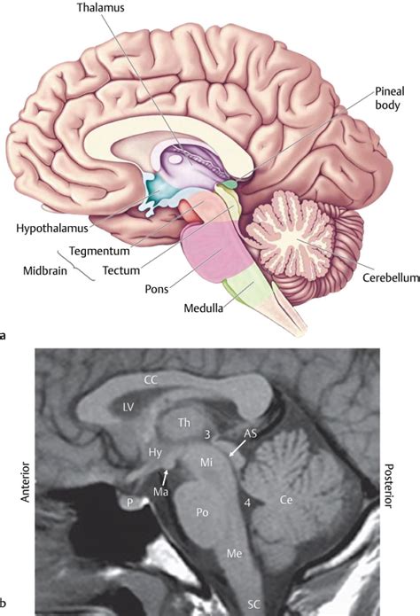3 Development Of The Human Brainstem And Its Vasculature Neupsy Key