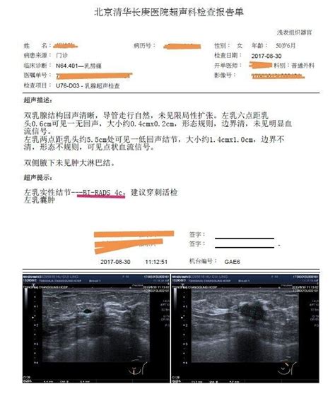 如何解读乳腺超声报告（bi Rads分类系统）及常见误区 微医（挂号网）