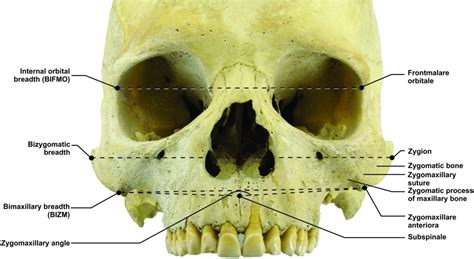 Zygomatic Process