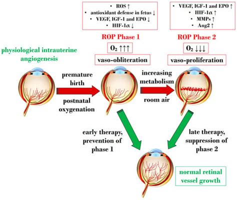 Pathophysiology Of Retinopathy Of Prematurity Encyclopedia Mdpi