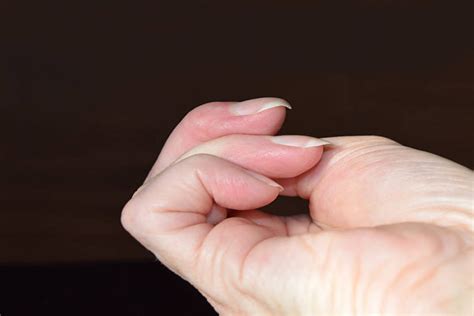 how to fix a vertical split nail 10