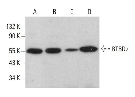 BTBD2抗体 H 2 SCBT Santa Cruz Biotechnology