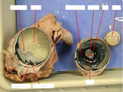 Eye Dissection Diagram Quizlet