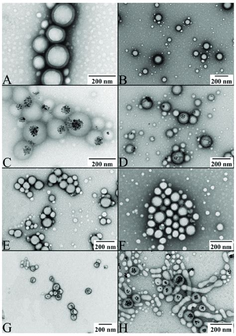 Tem Pictures Of A Plga Nanoparticles B Oxaliplatin Loaded Plga