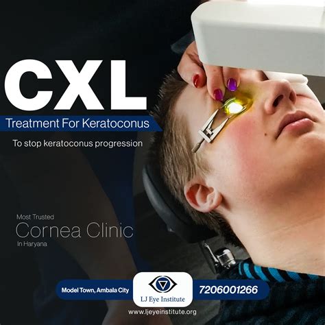 Keratoconus Treatment Lj Eye Institute