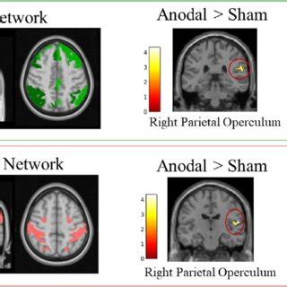 Identified Frontoparietal Network A And Dorsal Attention Network B