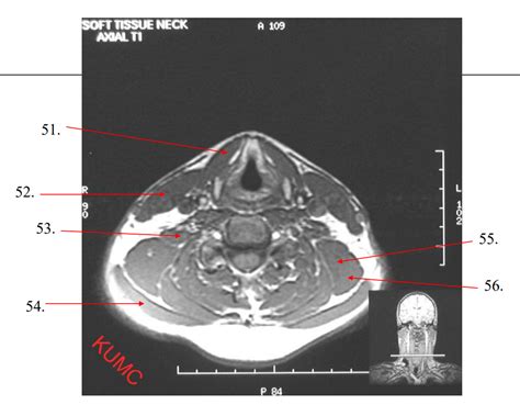 Mri Axial 5 Diagram Quizlet