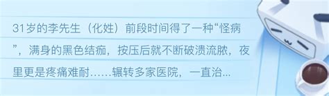 年轻男子全身结痂、流脓，中大皮肤团队解病痛 哔哩哔哩